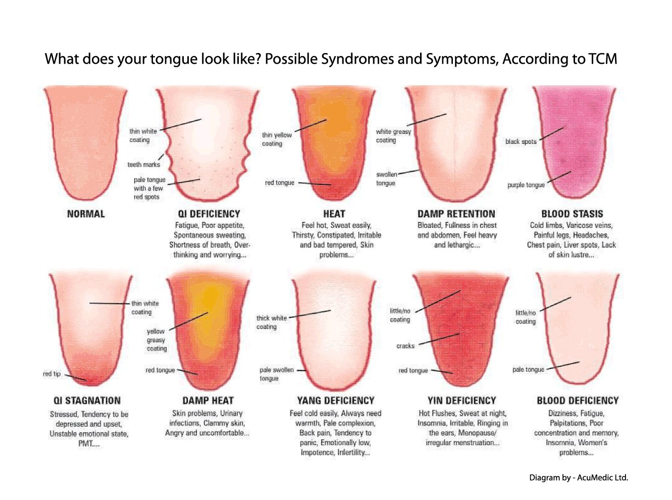 Acupuncturist looking 2025 at tongue hoax